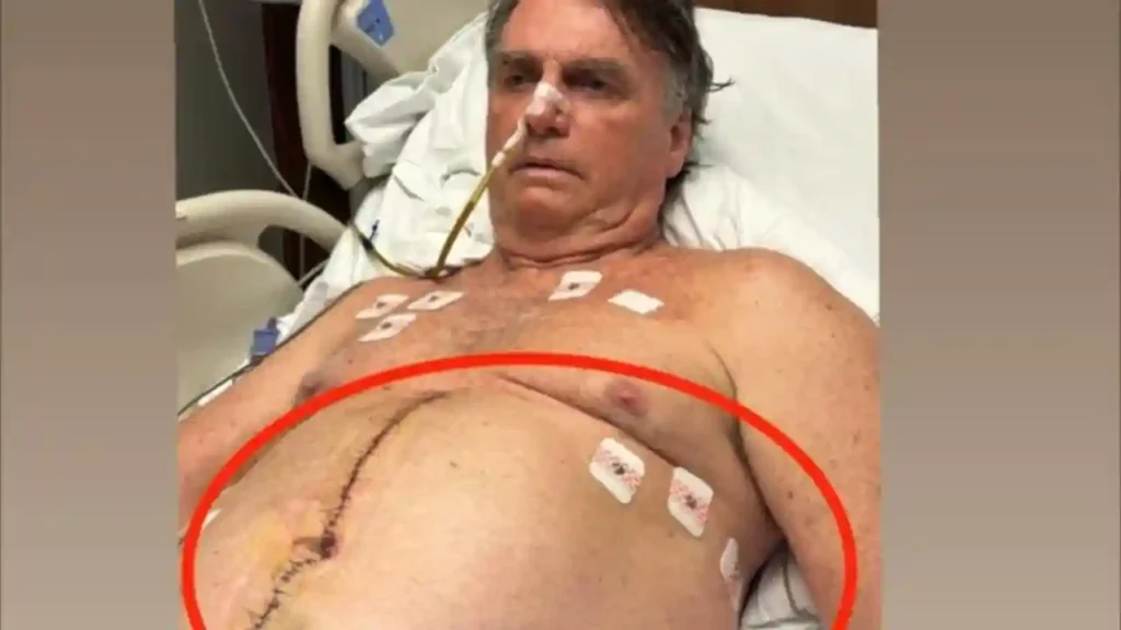 Silas Malafaia convoca jejum e oração por Jair Bolsonaro
