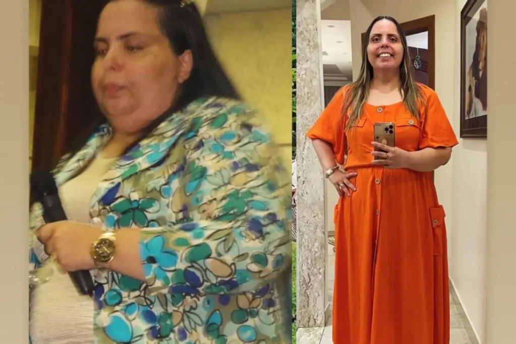 Helena Raquel compartilha transformação após cirurgia bariátrica
